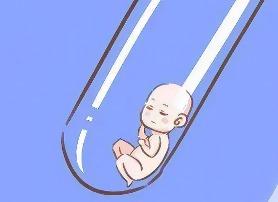 多囊患者一直想要成功怀孕需要做什么?