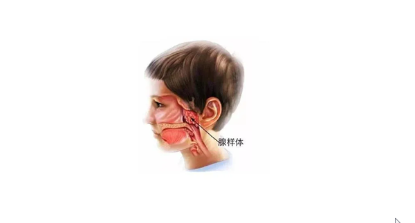 摘除孩子腺样体并无大伤害，听取医生才是正确