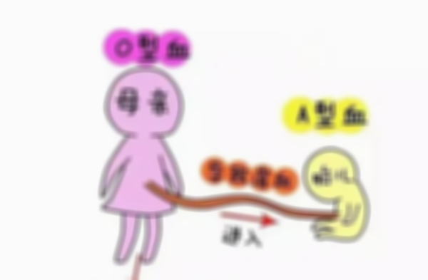 O型血怀孕生孩子要注意，小心溶血症找上门