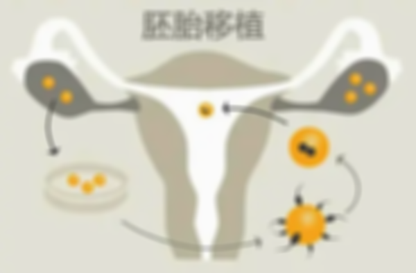 试管长方案的最佳移植时间取决于内膜的情况