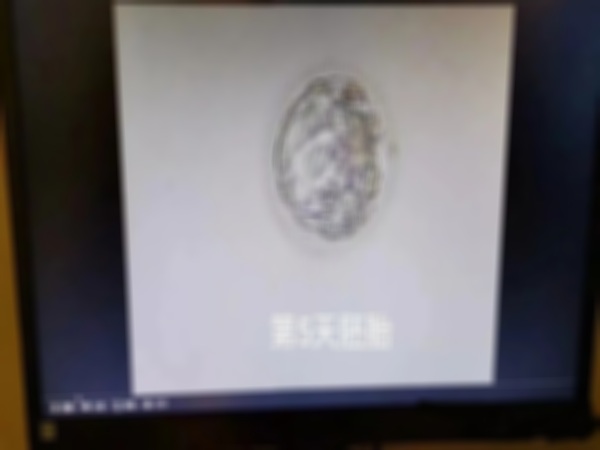D5冻胚有不同质量等级，弄清才可知晓移植成功率高不高