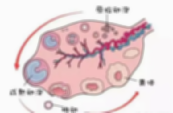 卵泡黄素化常见特征，可能会盆腔积液