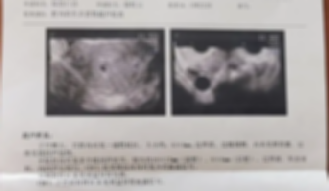 解析孕妇卵黄囊正常值范围