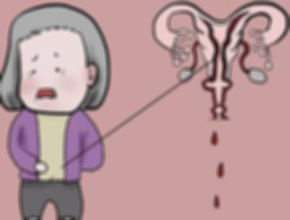 绝经意味着什么,一起来看一下绝经的分析