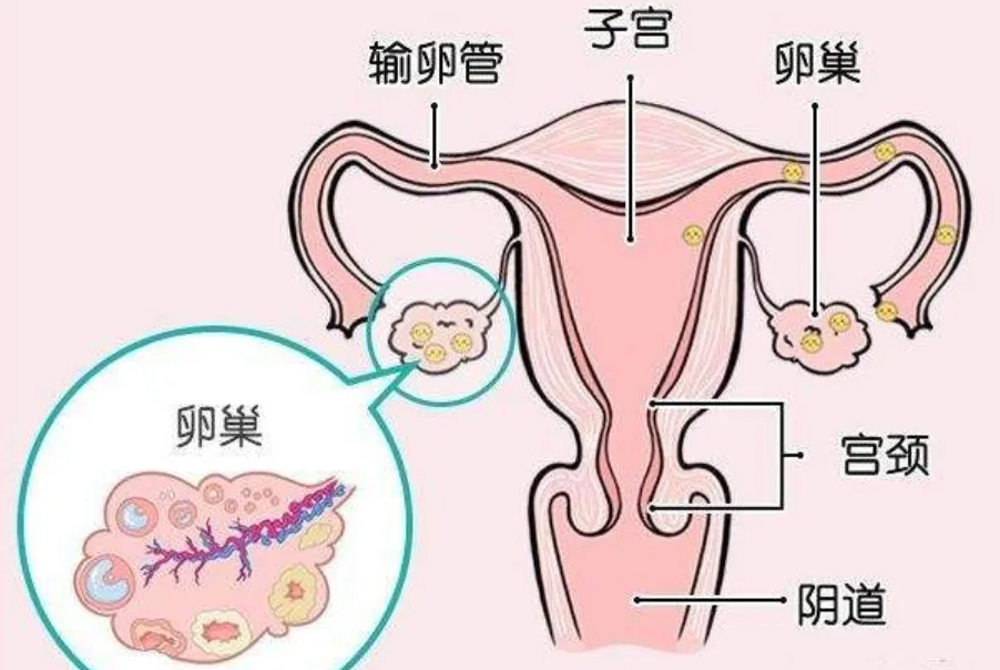 输卵管积水对试管有什么影响，需要切除吗？