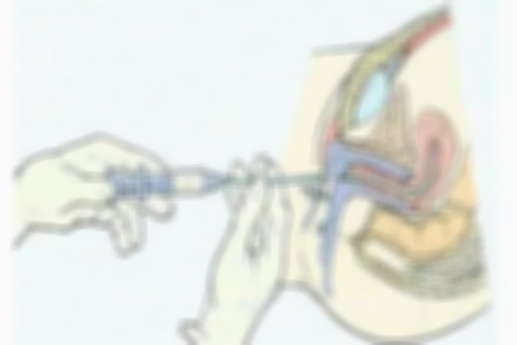 人工授精手术虽然简单但是对身体会产生这些不好之处你不得不知