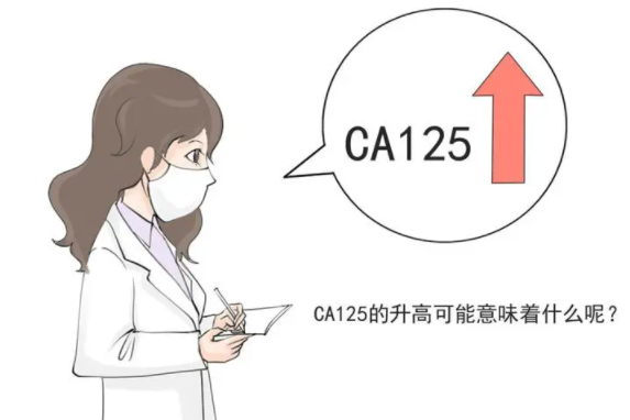 ca125偏高原因有这些，附注意事项一览