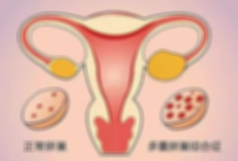 女性患有多囊卵巢之后能治愈吗？治疗多囊的方式与哪些呢？