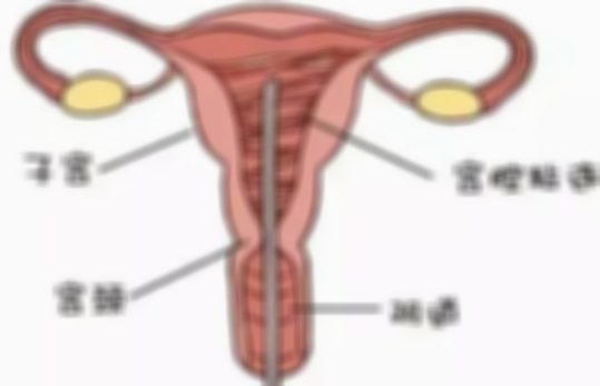 宫腔粘连怀孕之后会导致胎儿畸形吗？