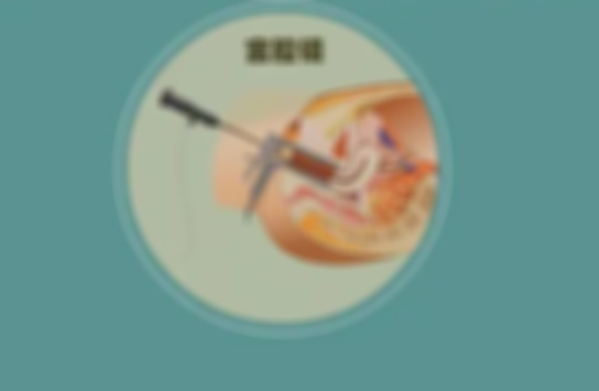 宫腔镜插管检查是怎么做的,宫腔镜插管是检查什么