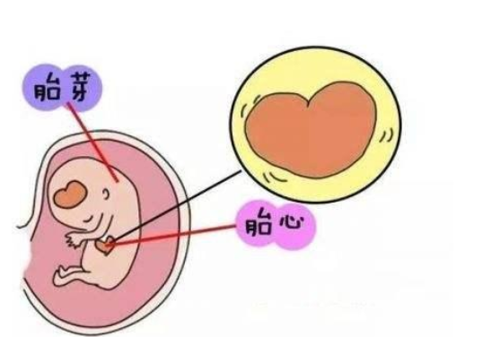 胎儿没有胎心是什么原因造成的,怀孕期间要注意哪些方面