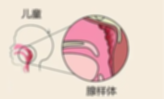 宝宝打呼噜一定是腺样体肥大吗,小孩腺样体肥大是怎么回事