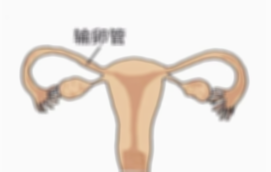 输卵管曲是否能够怀孕,输卵管曲张是怎么回事