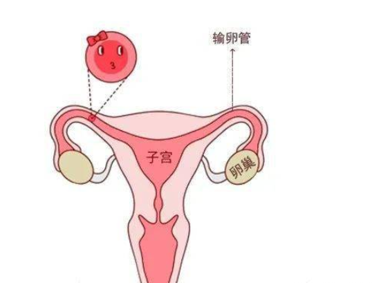 输卵管接通后怀孕几率大吗,输卵管接通后怀孕成功率有多少