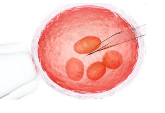 试管取卵后疼痛能接受吗,试管取卵后的症状有哪些