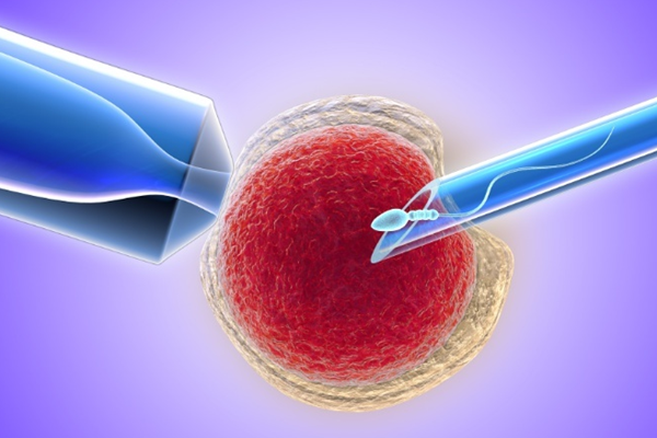 帶你揭開美國試管選性別的神秘面紗,這些要點要牢記