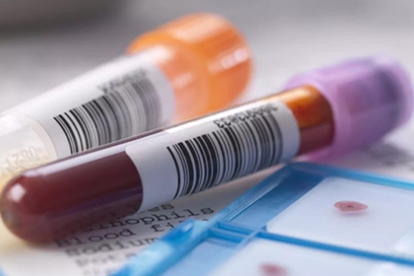 俄羅斯三代試管嬰兒成功率詳解,高成功率主要和這兩點有關