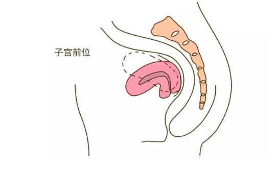 子宫前位生男孩还是生女孩,子宫前位跟怀男女有关系吗