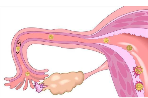 单侧卵巢试管受孕方法需了解,生育方法主要有这几种