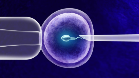 在俄罗斯做试管婴儿需要什么条件？这四个条件缺一不可