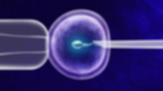 在俄羅斯做試管嬰兒需要什么條件?這四個條件缺一不可