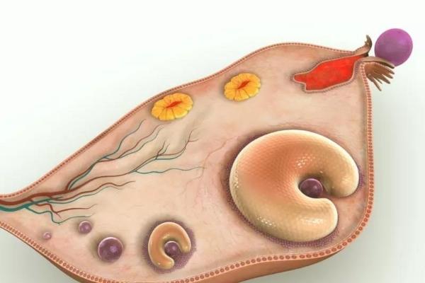空卵泡综合症是什么？如何判断及治疗？
