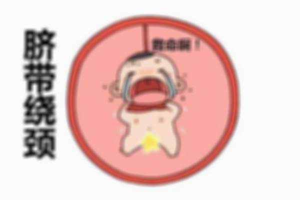 脐带绕颈是如何发生的？