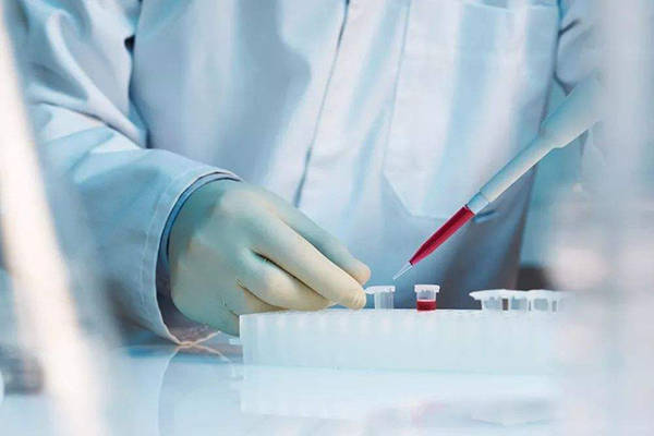 c糖耐检查必须做吗？解析你需要知道的答案