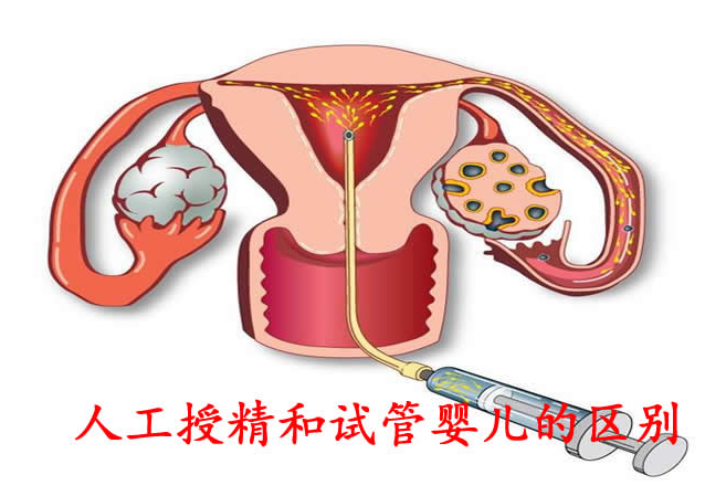 试管还是人工授精？40岁以后该怎么选择！