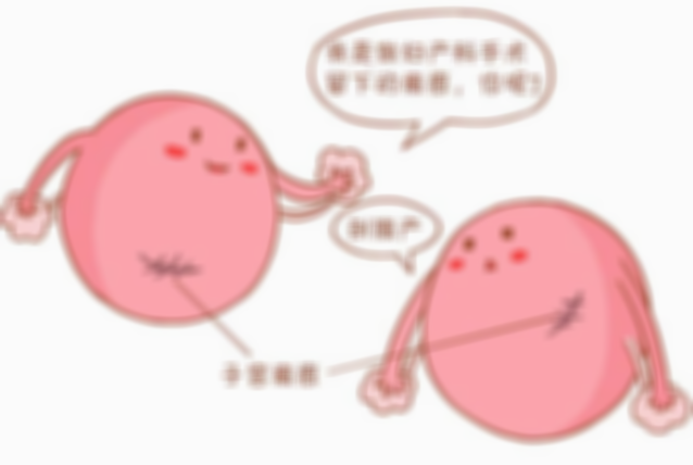 专家解析疤痕子宫二胎的风险，科学评估是否能分娩