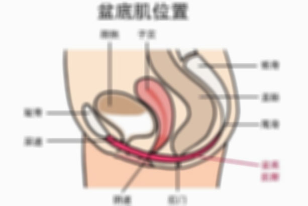 盆底肌修复为何不受医院推荐？四个重要原因曝光！
