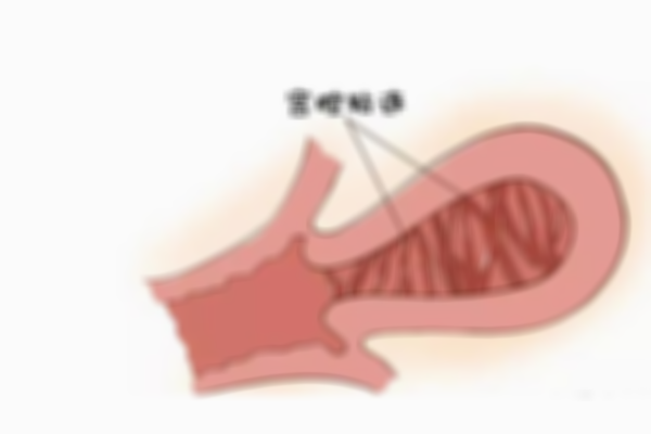 看准医生排名和性价比，深圳宫腔粘连手术首选哪家医院？