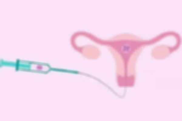 了解移植前宮腔灌注,三種方法你知多少