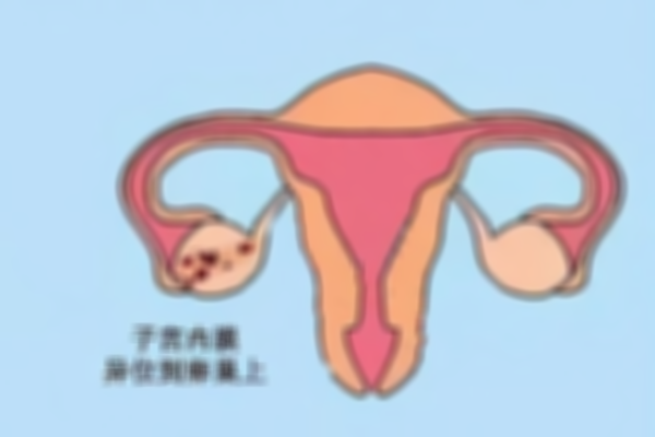 挑选成都子宫内膜异位症专科医院，手术省钱过半健康路上越走越近！