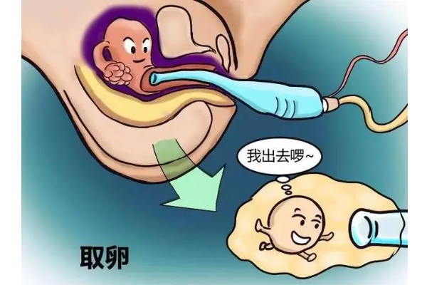 卵巢取卵后9天持续小腹疼痛不可忽视！危险仍伴卵巢扭转！