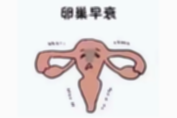 卵巢早衰为何不需要特别治疗？医生指出两大原因