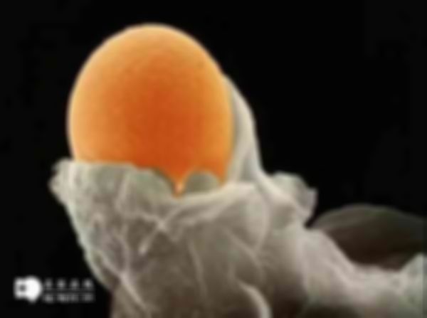 苏州做试管婴儿一个周期得多少钱？附上费用构成