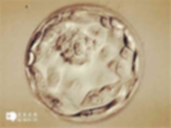 长春医院做试管婴儿需要多少钱？附上收费明细与详细流程