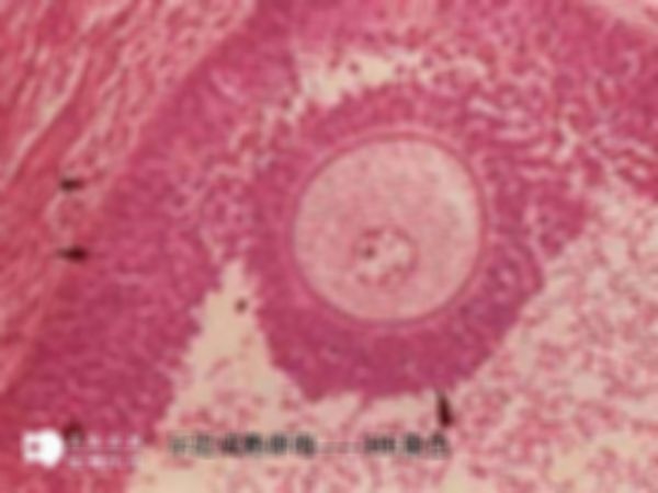 女性HIV携带者可以做三代试管婴儿吗？内附详细步骤和优势