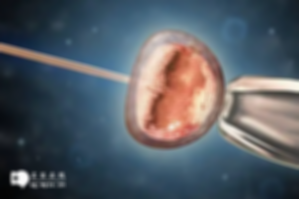 泰國試管嬰兒費用明細,最新助孕價格公開