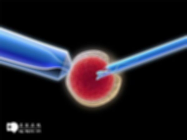 试管婴儿是否容易怀上双胞胎？附上怀孕双孪生囊的几率
