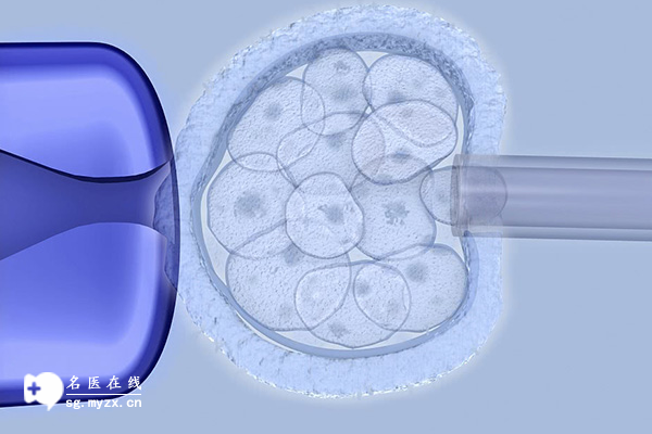 做试管受精时疼吗？读完文章你就明白了