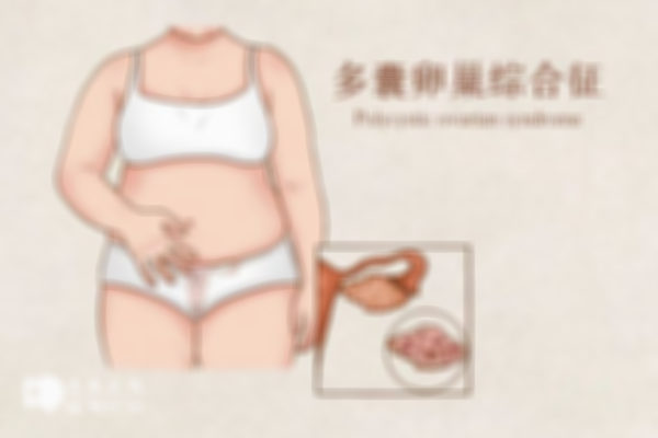 多囊卵巢能不能做试管婴儿？附上关系介绍