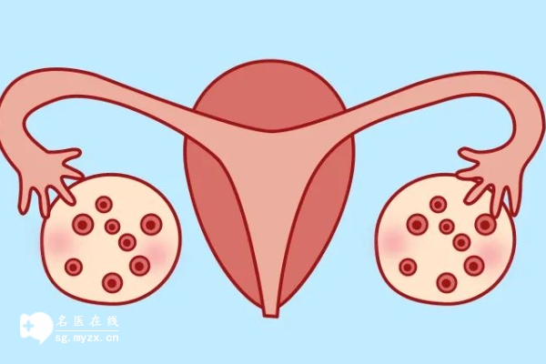 多囊卵巢症能做试管婴儿吗，具体试管步骤看这里