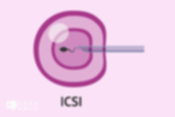 试管婴儿ICSI：内附操作过程和优势！