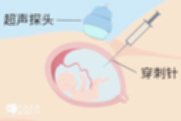 三代试管怀孕后不一定要做羊水穿刺，存在遗传疾病才需要进行检查