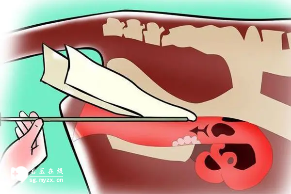 人工授精的成功率高不高？主要看着四方面的影响