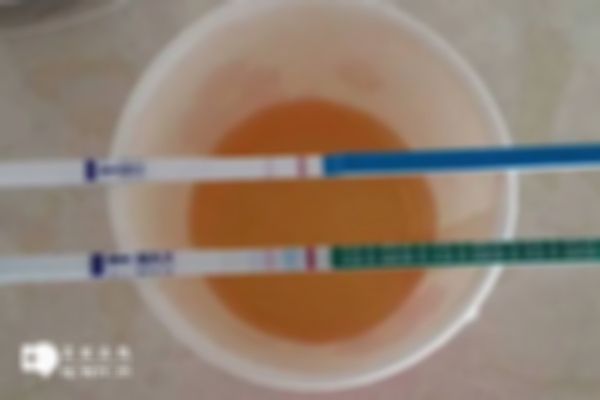 验孕棒尿太多会影响结果吗？看看尿多尿少的检测结果区别