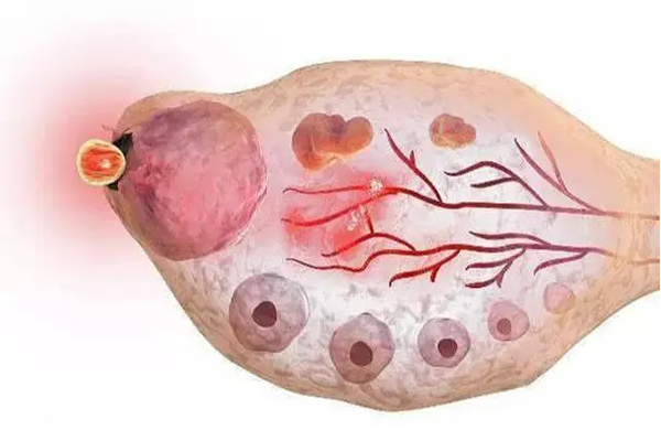 试管婴儿卵泡提前排掉了怎么办？内附原理解析和优势