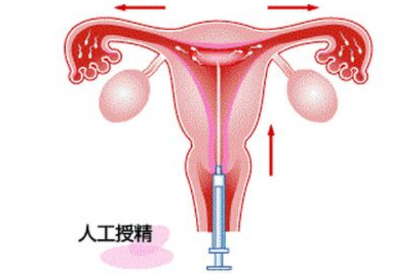 哈尔滨人工授精费用已公布，选择合适医院的方法看完就知道